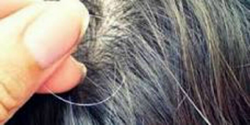 Goriau Rasulullah Saw Melarang Mencabut Uban Ini Penjelasan Ilmiahnya